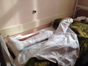 У девушке перелом таза и раздроблено колено