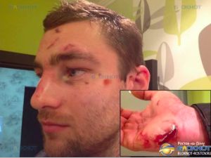 Игорь Салов после избиения