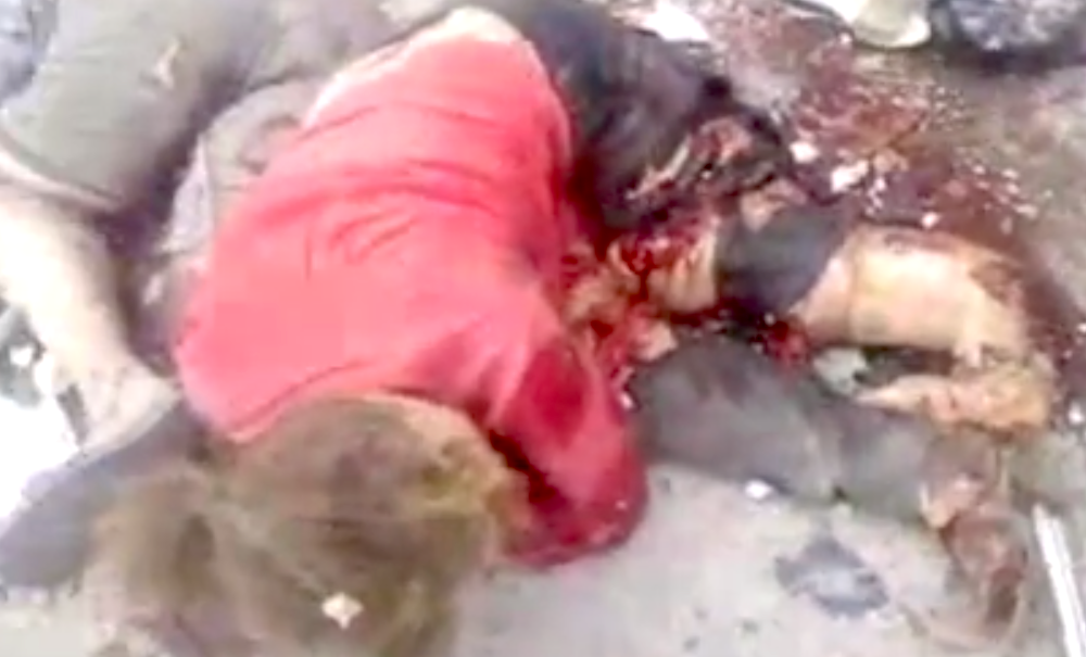 Луганск: дочь искалеченной взрывом женщины рассказала, как умирала ее мать 