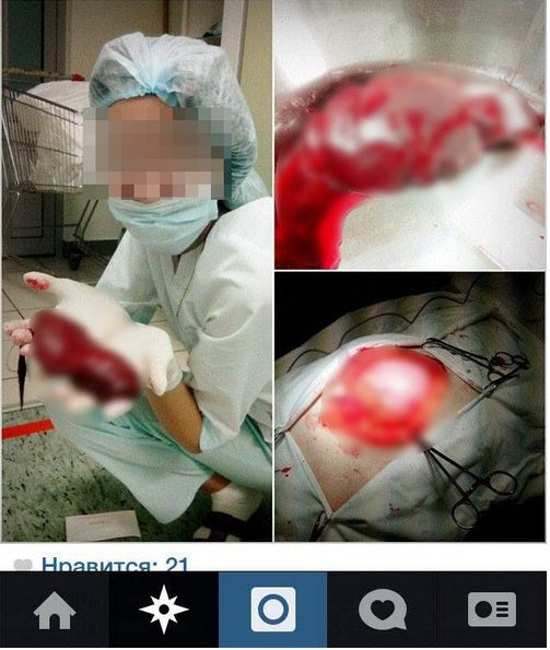 В Казани медсестра сфотографировалась с человеческими органами и выложила снимки в Instagram 