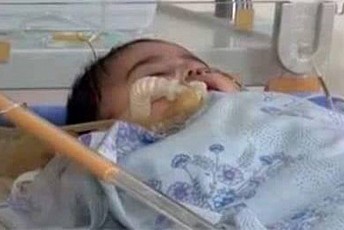 Рошаль сообщил о смерти ребенка, раненного во время трагедии в Гюмри 