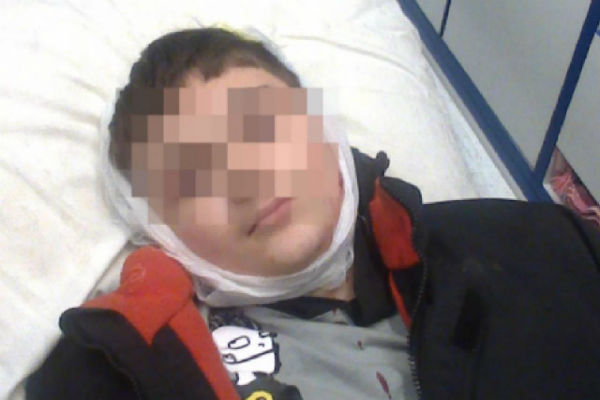 11-летнего мальчика тяжело ранили при обстреле Горловки 