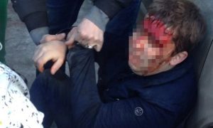 В Челябинске оперативники в штатском избили подозреваемого в сбыте наркотиков