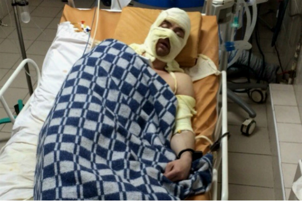 Взорвавший себя и девушку ростовский ревнивец оказался при смерти Взорвавший себя и девушку ростовский ревнивец оказался при смерти