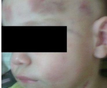 Житель Татарстана получил 4,5 года за избиение малыша кружкой 