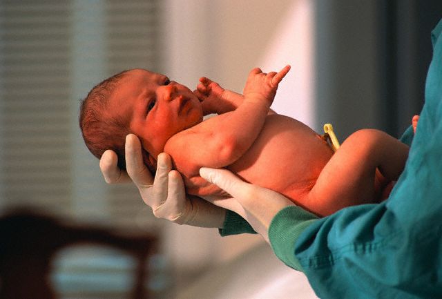 В США женщина с мертвым мозгом родила здорового малыша 
