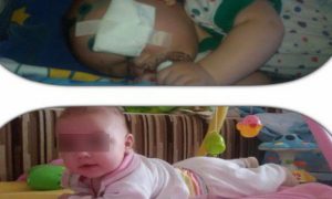 Малышу, пострадавшему от рук отца-изувера, на операцию требуется 1 млн