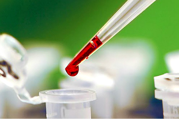 Ученые научились выявлять рак по капле крови за 3 минуты 
