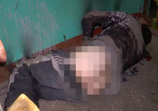 Умирающего в подъезде мужчину сожгли в Казани 