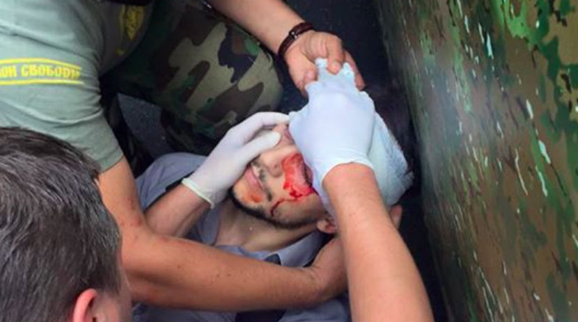 Французский журналист ранен в голову во время беспорядков в Киеве 