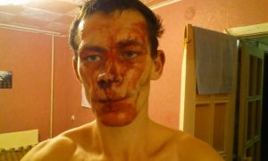 Изрубленный топором известный житель Красноярска опубликовал видео о нападении