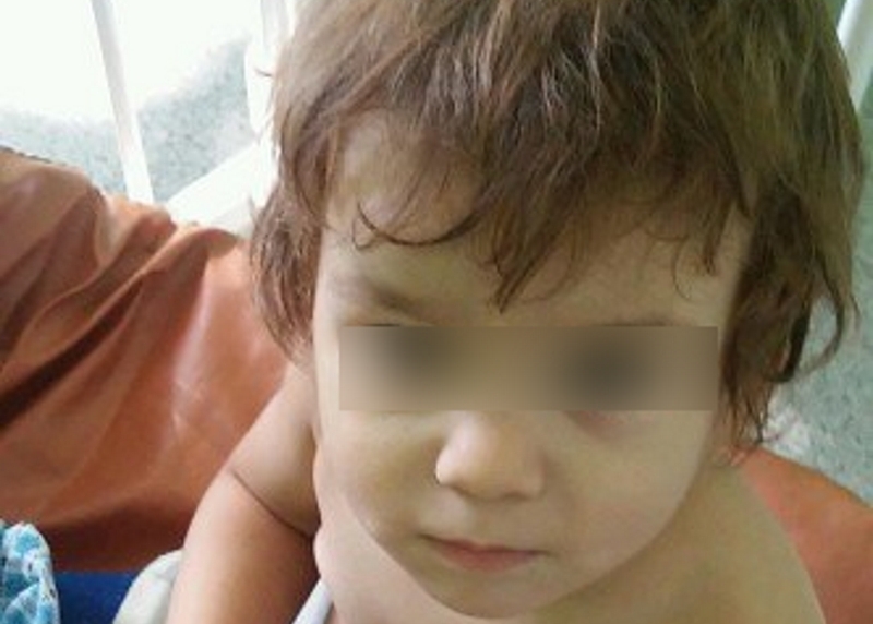 В Ростовской области двухлетний малыш четыре месяца живет в больнице 