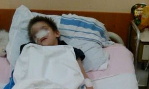 Избитый и заморенный голодом приемный ребенок попал в больницу Калининграда