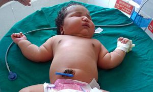 Ребенок-гигант весом почти 7 килограммов родился в Индии