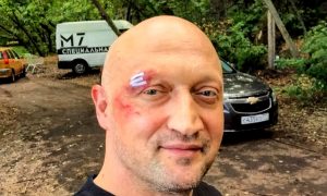 Избитый на рок-фестивале «Нашествие» Гоша Куценко шокировал поклонниц селфи «поцелуя березки»