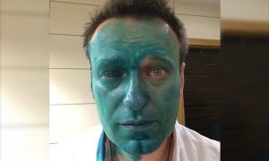 Облитому зеленкой Навальному вызвали 