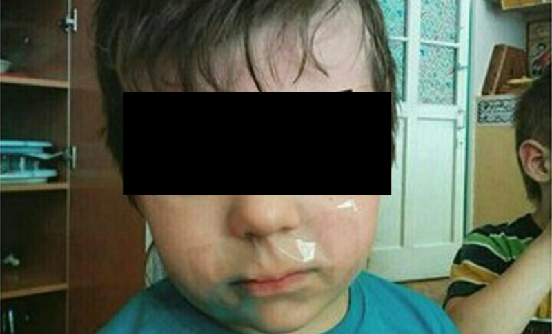 Воспитательница из Иркутской области выложила в соцсети фото ребенка с заклеенным ртом 