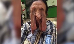 Тайская бабушка с редким недугом отказалась от операции из-за боязни смерти