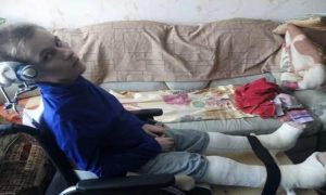В Кургане подростка-инвалида не пустили в самолет из-за гипса на ногах