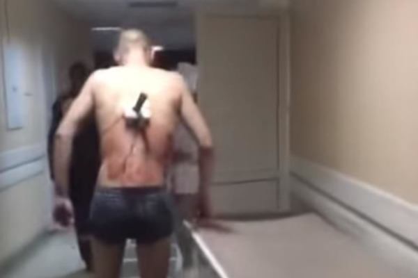 В больнице Татарстана пациент с ножом в спине вышел покурить 