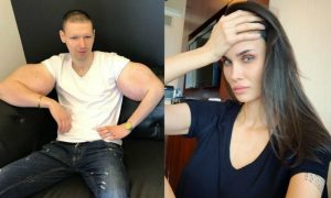 Алана Мамаева отвела Кирилла «Руки-базуки» на операцию по удалению синтола