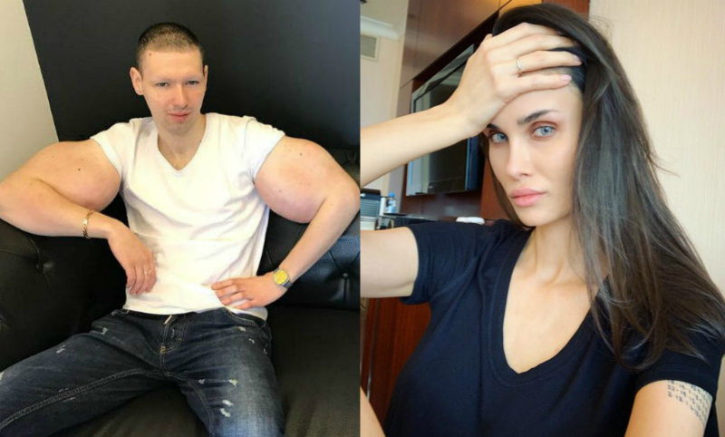 Алана Мамаева отвела Кирилла «Руки-базуки» на операцию по удалению синтола 