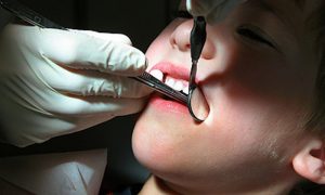 «Бастрыкин потребовал доклад»: что известно о гибели ребёнка после приёма у стоматолога в Рязани