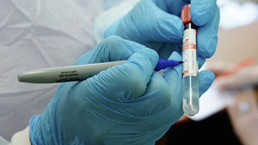 Роспотребнадзор предложил провести желающим тестирование на коронавирус на дому 