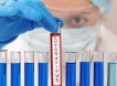 Биолог объяснила ошибки в тестах на коронавирус