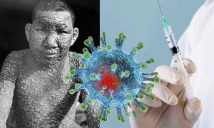 Прививка от коронавируса: вспоминая оспу, как биологическое оружие