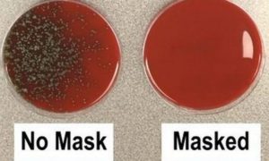 Врач-микробиолог положил конец спорам о маске на наглядном примере