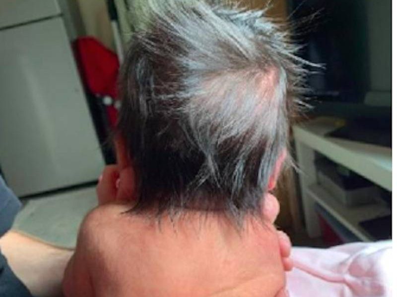 Почему у ребенка появляются седые волосы на голове у себя