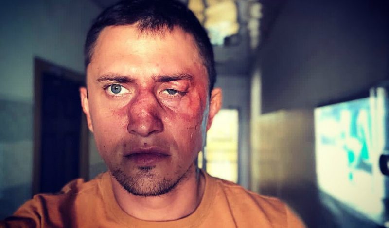 Павел Прилучный выступил с заявлением после истории с избиением 