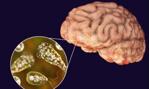 Страшнее, чем COVID: из-за потепления пожирающие мозг амебы расширяют ареал обитания и движутся на север