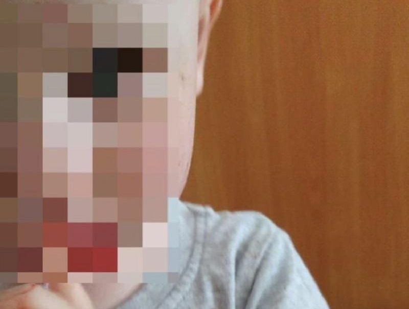 Малыша забрали из частного детского сада в Ставрополе с кровавыми ссадинами на лице 