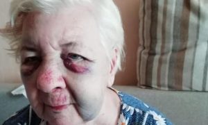 В Волгограде 84-летнюю избитую пенсионерку в 4 утра выставили из больницы