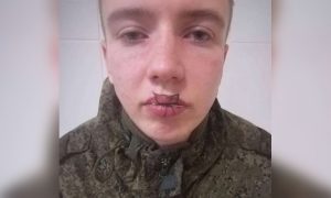 «У него просто крыша поехала»: в воинской части под Челябинском срочник зашил себе рот после ссоры с девушкой