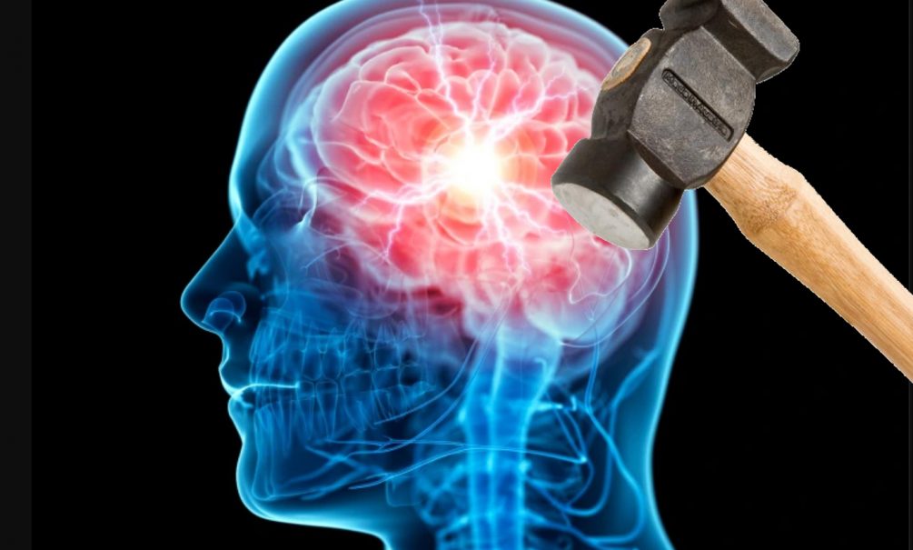 Семь ударов по голове: британский профессор рассказал, как COVID поражает мозг 