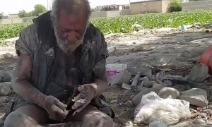 «Такой грязный — и такой чистый»: человек не мылся 67 лет и поразил медиков железным здоровьем