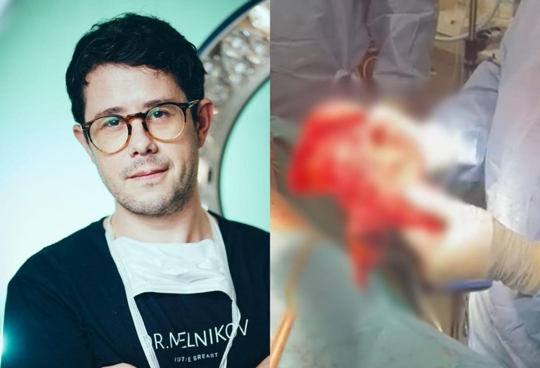 В Швейцарии отказались - в России сделали: хирург Дмитрий Мельников провел уникальную операцию 