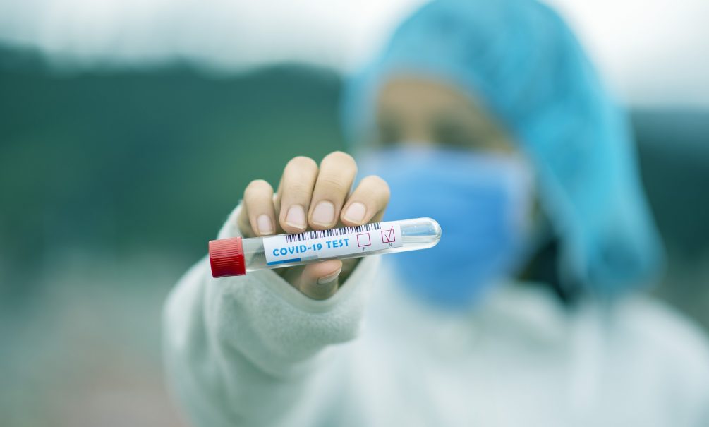 «Это навсегда!»: вакцину от COVID-19 с пожизненным иммунитетом разрабатывают в Японии 