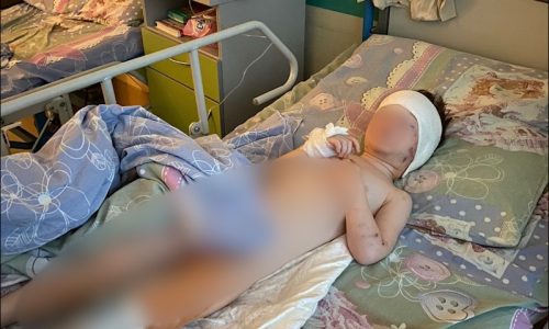 «Оторвала капюшон, стала грызть шею»: в Подмосковье бойцовская собака напала на женщину с трехлетним ребенком
