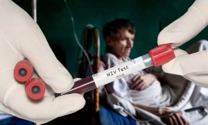 Инфекционист назвала россиянам первые симптомы ВИЧ-инфекции