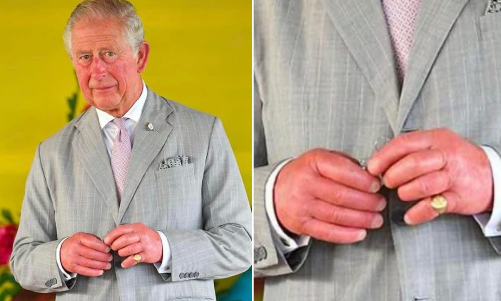 «Король Сосисочные пальцы»: опухшие руки британского монарха Карла III говорят о серьезном заболевании 