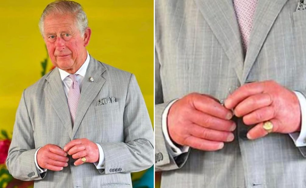 Король Сосисочные пальцы»: опухшие руки британского монарха Карла III  говорят о серьезном заболевании — Блокнот Россия