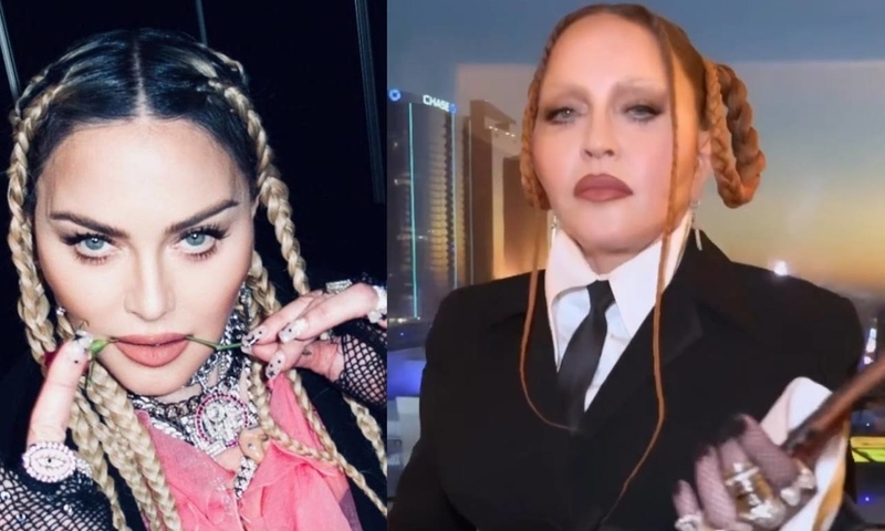 «Стареть достойно нельзя?»: Мадонна испугала поклонников перетянутым лицом на «Грэмми» 