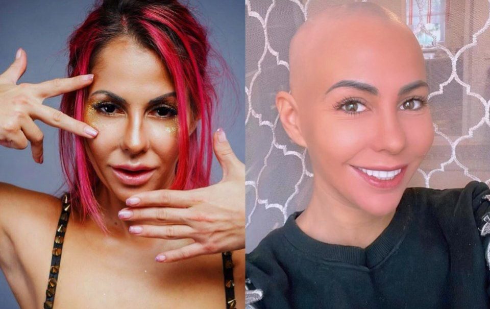 Звезда фильмов для взрослых Беркова полностью облысела: «Алопеция пришла с букетом из депрессии и тревожного расстройства Звезда фильмов для взрослых Беркова полностью облысела: «Алопеция пришла с букетом из депрессии и тревожного расстройства