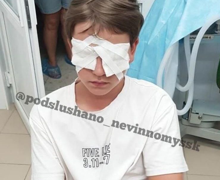 В летнем лагере Невинномысска пятикласснику выбили глаза 