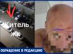 Полиция на вызов не приехала: в Новой Москве мужчина получил сотрясение мозга в драке с толпой иностранцев
