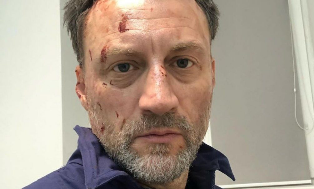 Во Франции отменили гастроли сбежавшего из России Анатолия Белого Во Франции отменили гастроли сбежавшего из России Анатолия Белого